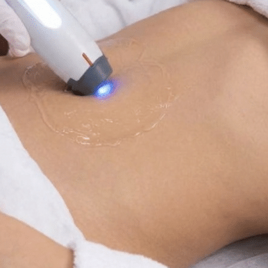 Xerf - brucho/ stehná / paže / kolená